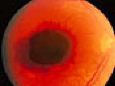 oeil_humide_400